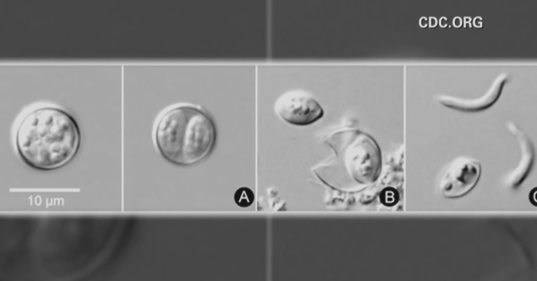 Cyclosporiasis parasitic illness cases in Maryland increase by dozens since May 1 – CBS News